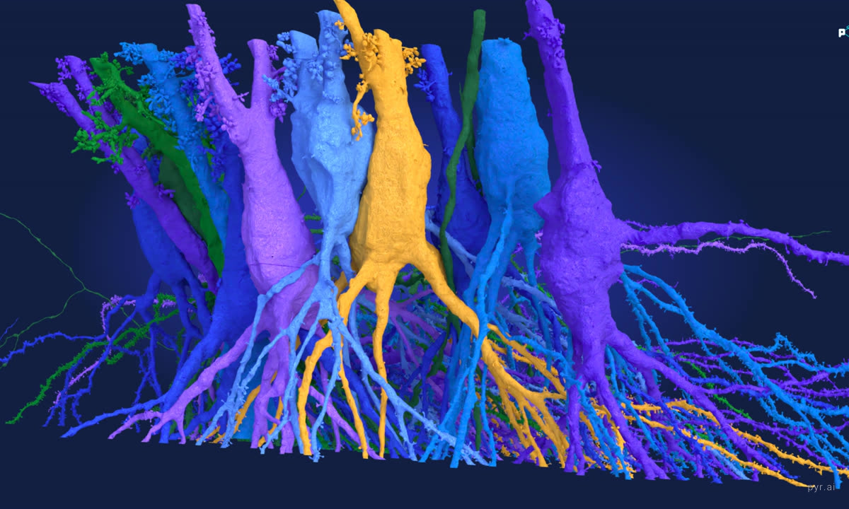 Pyramidal cell bodies covered in thorny excrescences